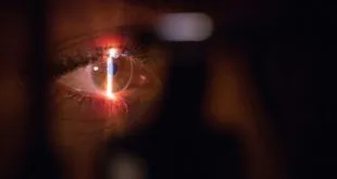 Presbyopia Treatment